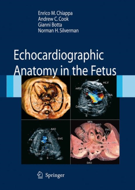 Echocardiographic Anatomy in the Fetus, Hardback Book