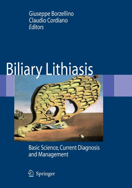 Biliary Lithiasis : Basic Science, Current Diagnosis and Management, Hardback Book