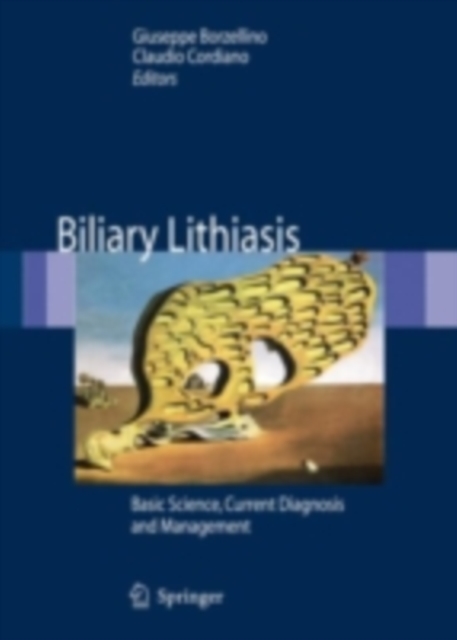 Biliary Lithiasis : Basic Science, Current Diagnosis and Management, PDF eBook