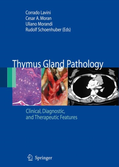 Thymus Gland Pathology : Clinical, Diagnostic and Therapeutic Features, Paperback / softback Book