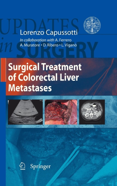 Surgical Treatment of Colorectal Liver Metastases, Hardback Book