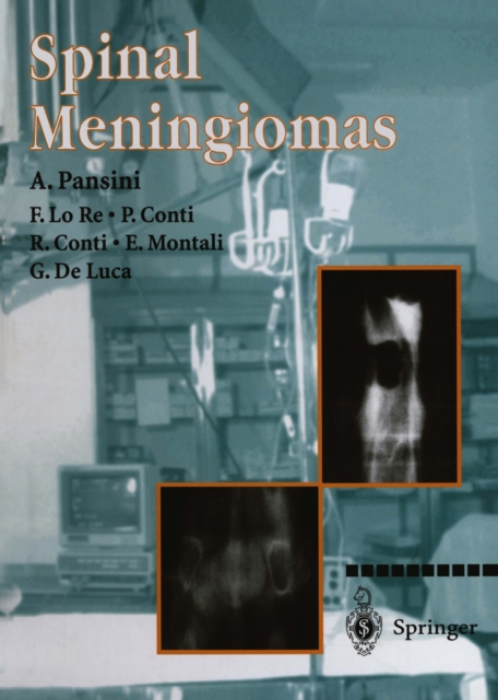 Spinal Meningiomas, PDF eBook