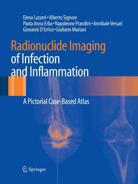Radionuclide Imaging of Infection and Inflammation : A Pictorial Case-Based Atlas, Paperback / softback Book