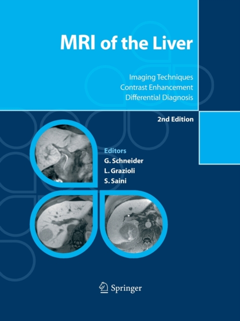 MRI of the Liver : Imaging Techniques, Contrast Enhancement, Differential Diagnosis, Paperback / softback Book