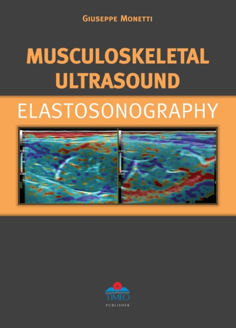 Musculoskeletal Ultrasound Elastosonography, Hardback Book