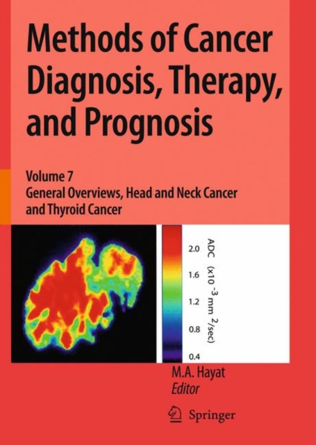 Methods of Cancer Diagnosis, Therapy, and Prognosis : General Overviews, Head and Neck Cancer and Thyroid Cancer, Hardback Book