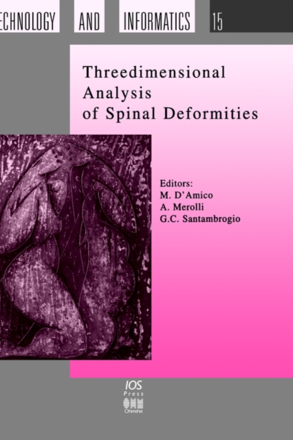 Three Dimensional Analysis of Spinal Deformities, Hardback Book