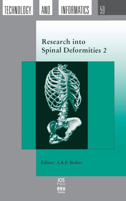 Research into Spinal Deformities 2 : Proceedings of the 2nd Biannual Meeting of the International Research Society of Spinal Deformities, Hardback Book