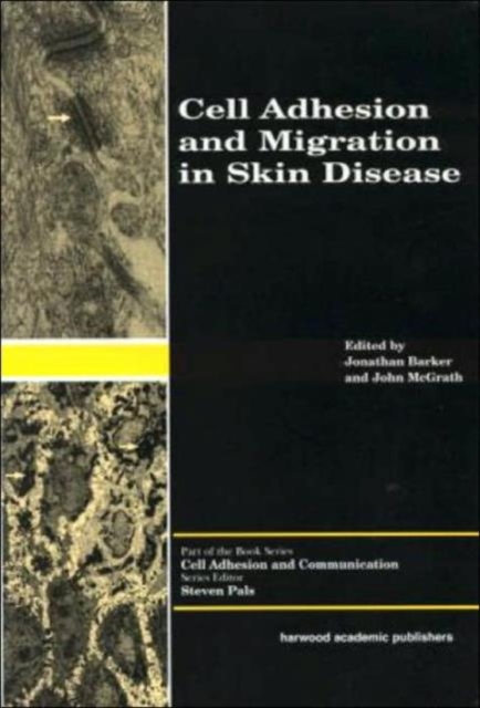 Cell Adhesion and Migration in Skin Disease, Hardback Book