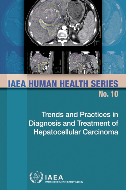 Trends and Practices in Diagnosis and Treatment of Hepatocellular Carcinoma, Paperback / softback Book