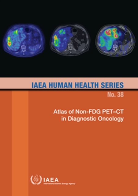 Atlas of Non-FDG PET-CT in Diagnostic Oncology, Paperback / softback Book