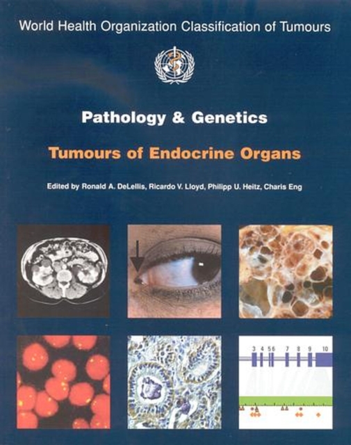 Pathology and genetics of tumours of the endocrine organs, Paperback / softback Book