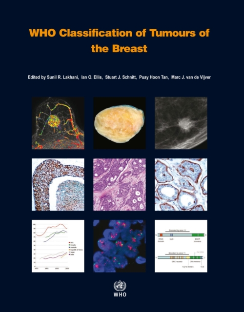WHO classification of tumours of the breast, Paperback / softback Book