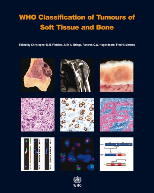 WHO classification of tumours of soft tissue and bone, Paperback / softback Book