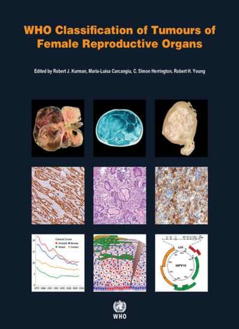 WHO classification of tumours of female reproductive organs, Paperback / softback Book