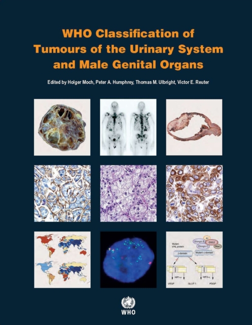 WHO classification of tumours of the urinary system and male genital organs, Paperback / softback Book