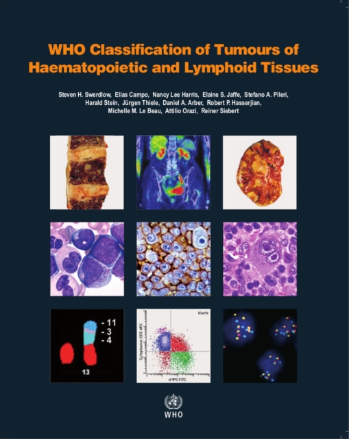 WHO classification of tumours of haematopoietic and lymphoid tissues : Vol. 2, Paperback / softback Book