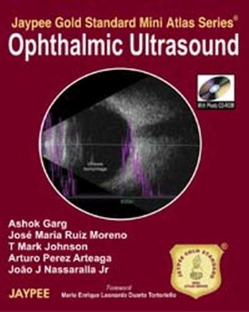 Jaypee Gold Standard Mini Atlas Series: Ophthalmic Ultrasound, Multiple-component retail product Book