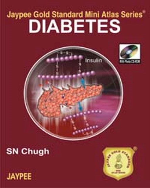 Jaypee Gold Standard Mini Atlas Series: Diabetes, Paperback / softback Book