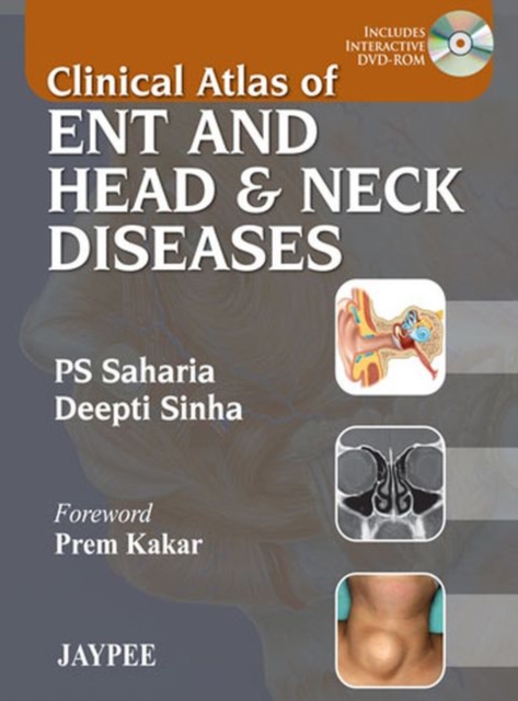 Clinical Atlas of ENT and Head & Neck Diseases, Mixed media product Book