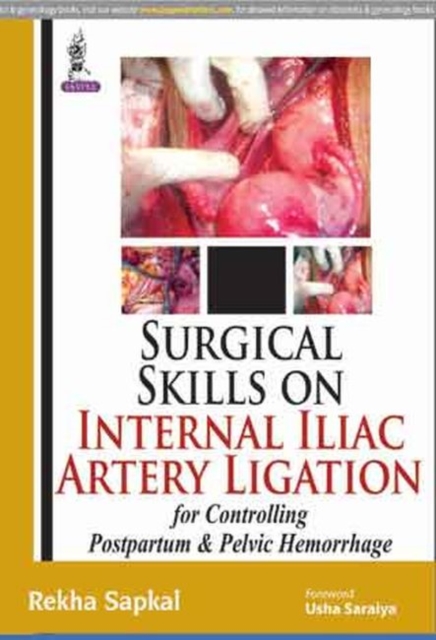 Surgical Skills on Internal Iliac Artery Ligation for Controlling  Postpartum and Pelvic Hemorrhage, Paperback / softback Book