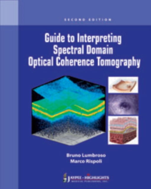 Guide to Interpreting Spectral Domain Optical Coherence Tomography, Paperback / softback Book