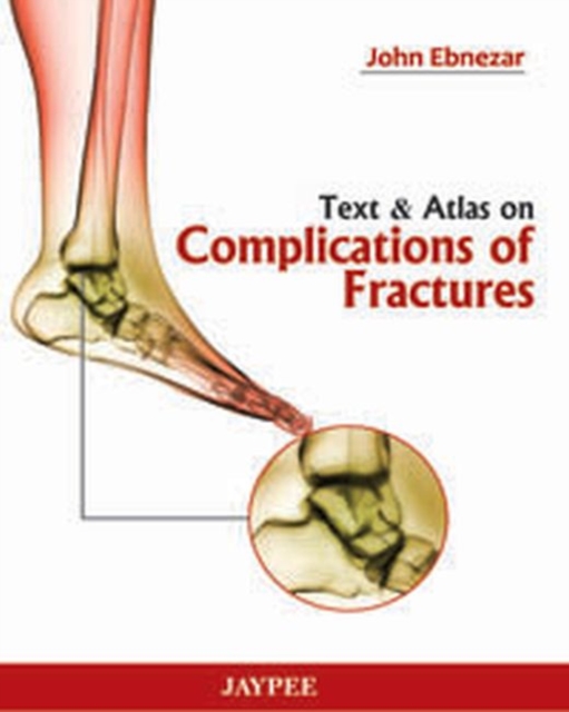 Text and Atlas of Complications of Fractures, Hardback Book