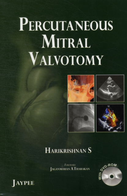 Percutaneous Mitral Valvotomy, Paperback Book