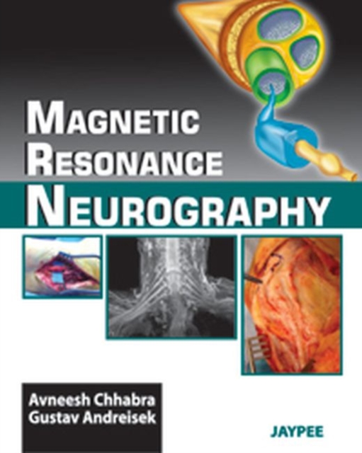Magnetic Resonance Neurography, Hardback Book