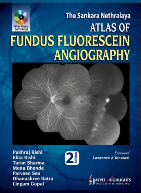 Atlas of Fundus Fluorescein Angiography, Hardback Book