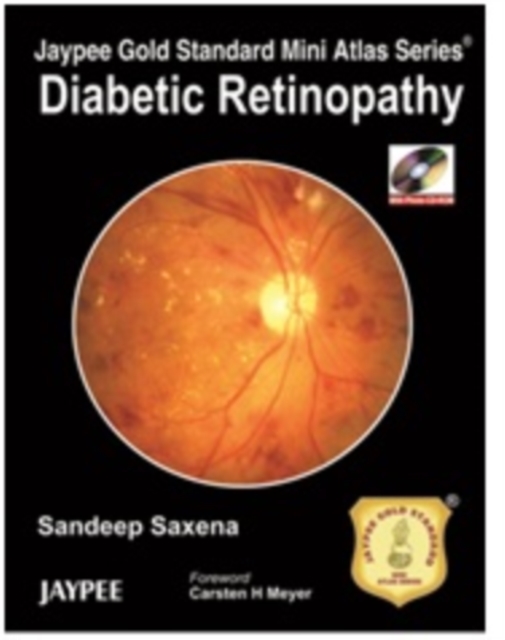 Jaypee Gold Standard Mini Atlas Series: Diabetic Retinopathy, Paperback / softback Book