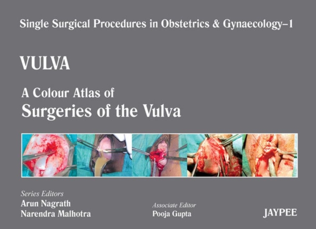 Single Surgical Procedures in Obstetrics and Gynaecology - Volume 1 - VULVA : A Colour Atlas of Surgeries of the Vulva, Hardback Book