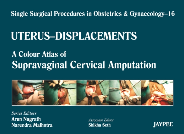 Single Surgical Procedures in Obstetrics and Gynaecology - Volume 16 - UTERUS - DISPLACEMENTS : A Colour Atlas of Supravaginal Cervical Amputation (Nadkarni's), Hardback Book