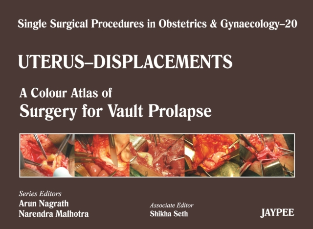 Single Surgical Procedures in Obstetrics and Gynaecology - Volume 20 - UTERUS - DISPLACEMENTS : A Colour Atlas of Surgery for Vault Prolapse, Hardback Book