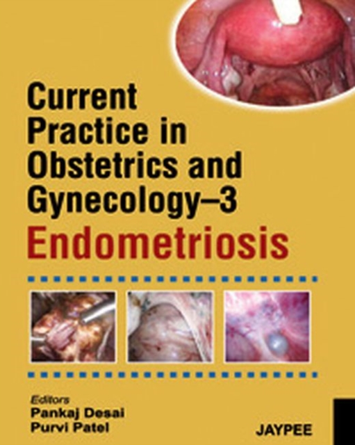 Current Practice in Obstetrics and Gynecology Endometriosis, Paperback / softback Book