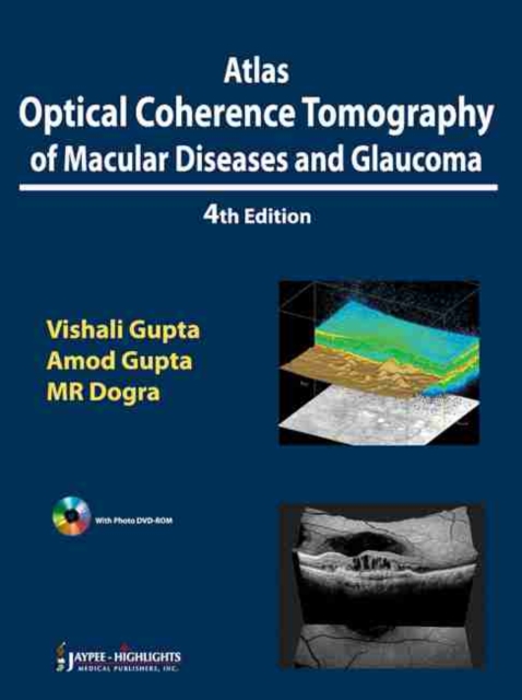 Atlas Optical Coherence Tomography of Macular Diseases and Glaucoma, Mixed media product Book