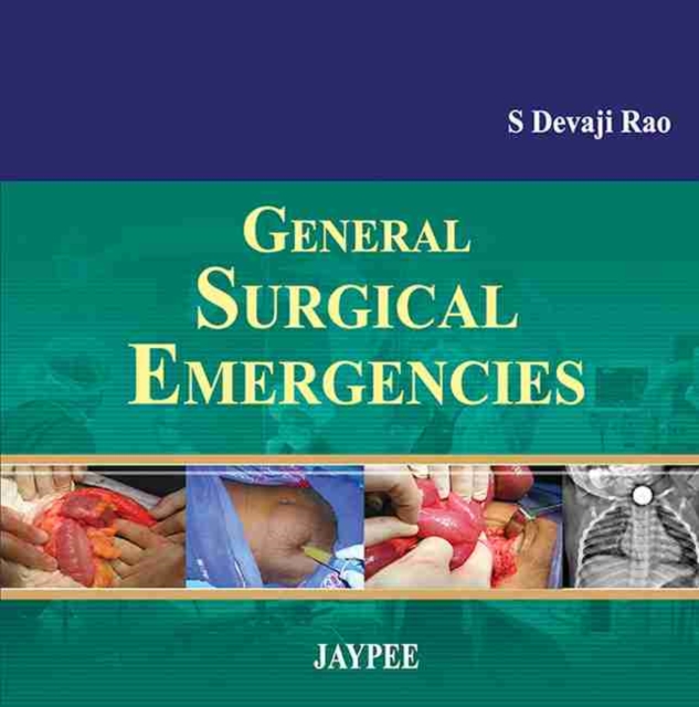 General Surgical Emergencies, Paperback / softback Book