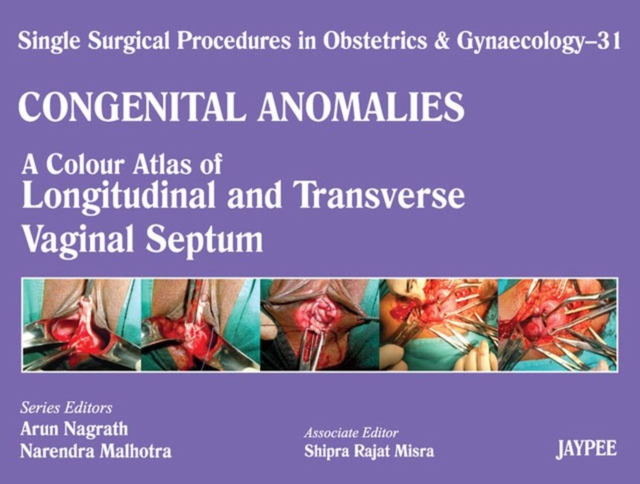 Single Surgical Procedures in Obstetrics and Gynaecology - Volume 31 : A Colour Atlas of Longitudenal and Transverse Vaginal Septum, Hardback Book