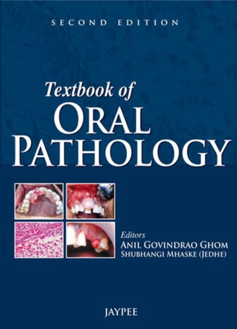 Textbook of Oral Pathology, Paperback / softback Book