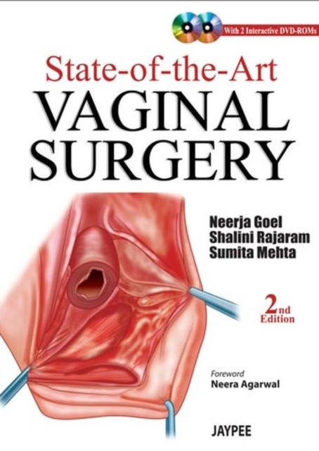 State-of-the-Art Vaginal Surgery, Hardback Book