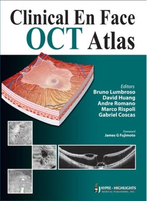 Clinical En Face OCT Atlas, Hardback Book