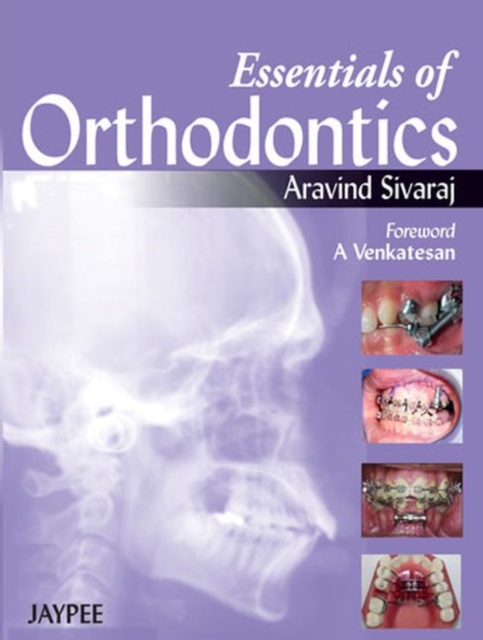 Essentials of Orthodontics, Paperback / softback Book