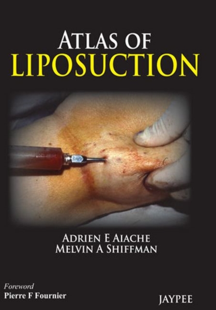 Atlas of Liposuction, Hardback Book