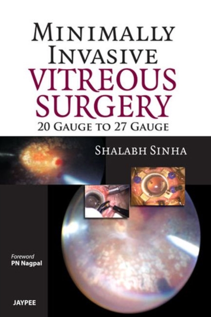 Minimally Invasive Vitreous Surgery: 20 Gauge to 27 Gauge, Paperback / softback Book