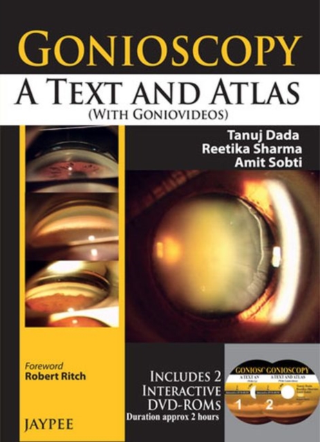 Gonioscopy: A Text and Atlas (with Goniovideos), Mixed media product Book