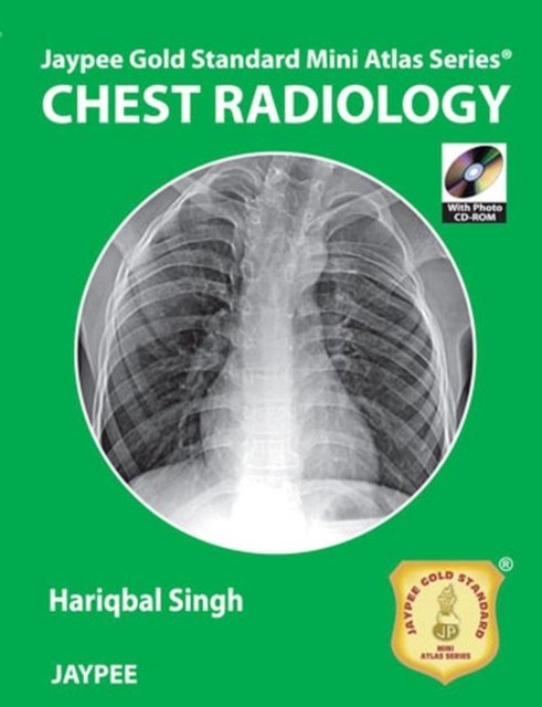 Jaypee Gold Standard Mini Atlas Series: Chest Radiology, Paperback / softback Book