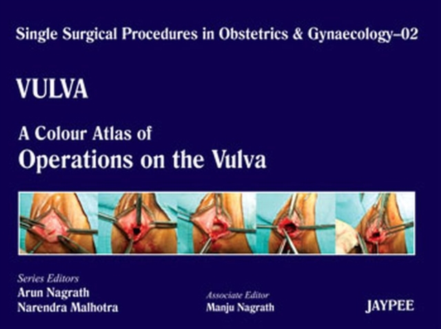 Single Surgical Procedures in Obstetrics and Gynaecology - Volume 2 - VULVA - A Colour Atlas of Operations on the Vulva, Hardback Book