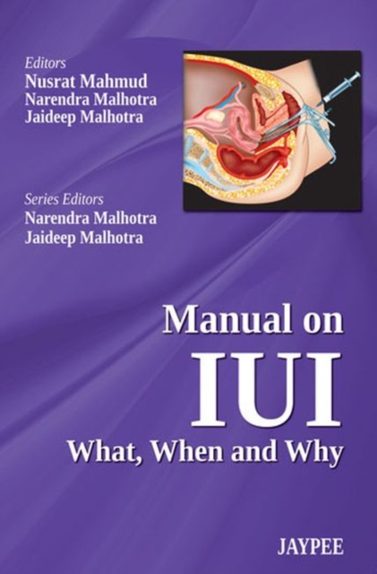 Manual on IUI: What, When and Why, Paperback / softback Book