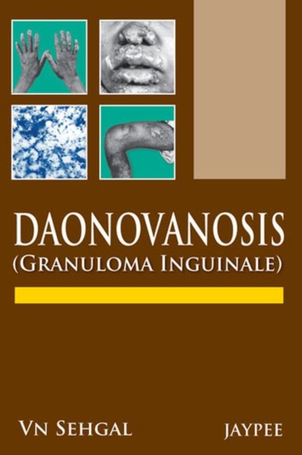 Donovanosis (Granuloma Inguinale), Paperback / softback Book
