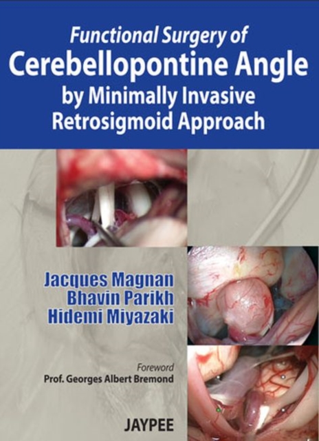 Functional Surgery of Cerebellopontine Angle by Minimally Invasive Retrosigmoid Approach, Hardback Book